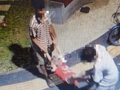 Keterangan Foto: MWP (6), anak penyandang disabilitas yang menjadi korban dugaan bullying dan persekusi di Taman Kramat Pulo, Senen, Jakarta Pusat, Minggu (7/6/2026). Akibat peristiwa tersebut, korban mengalami luka pada kepala, tangan, kaki, dan alat vital, serta mengalami pelemahan saraf pascakejadian.